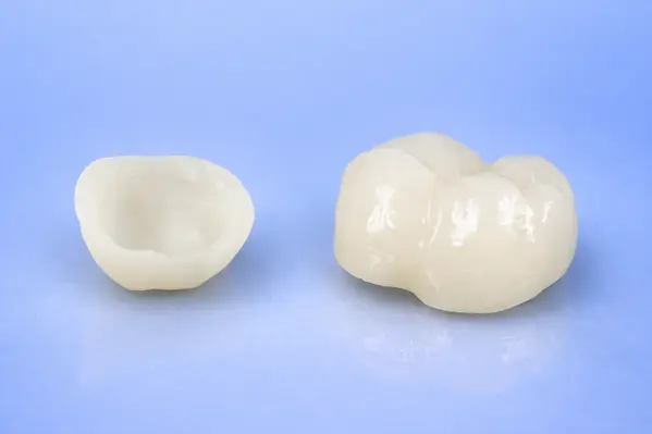 All-ceramic dental crown matching natural teeth