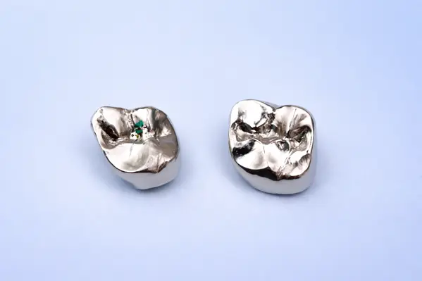 Metal dental crown on a back tooth