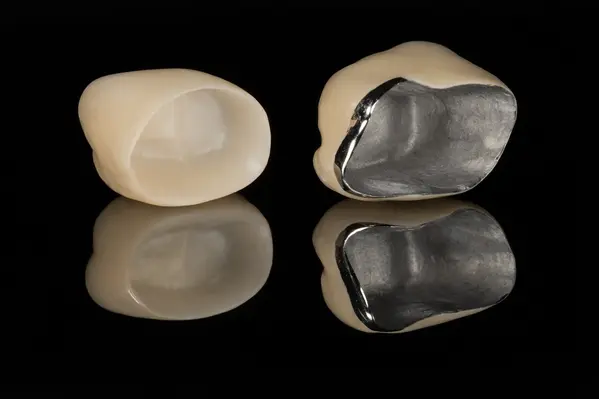 Porcelain-fused-to-metal PFM dental crown