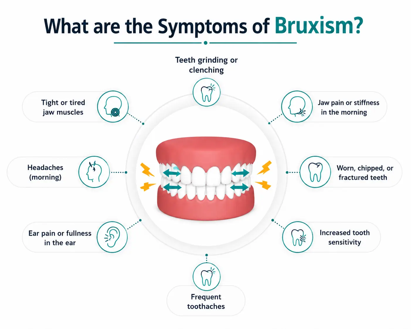 Infographic showing common symptoms of bruxism including jaw pain and headaches