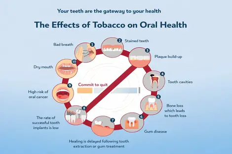 Effect of tobacco on teeth