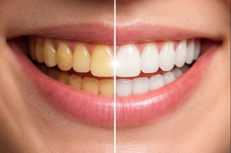 teeth stains image
