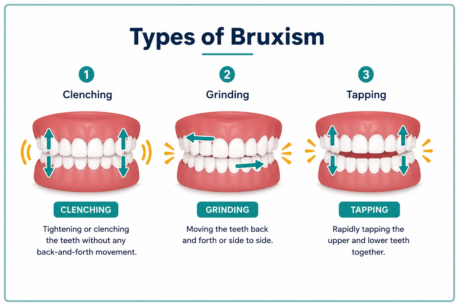 Types of bruxism infographic showing clenching, grinding and tapping