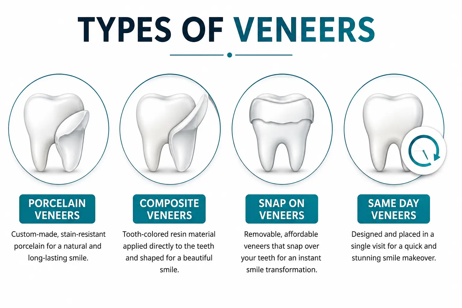 Infographic showing types of dental veneers including porcelain, composite, snap-on and same-day veneers
